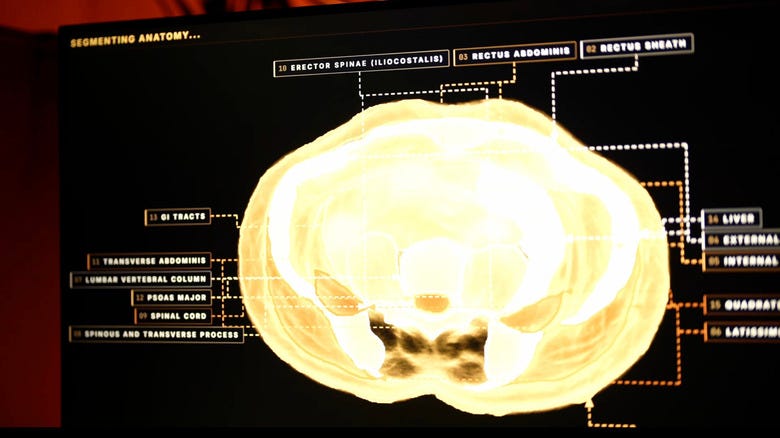 Scan of a human body Scan of a human body