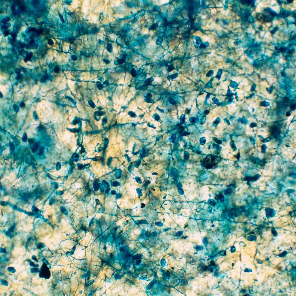 Your Home Could Be Making You Sick