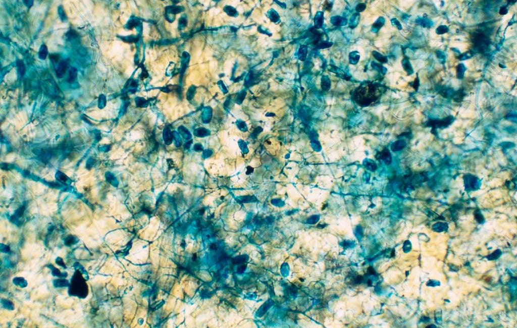 Your Home Could Be Making You Sick