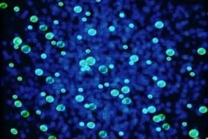 Bacteria