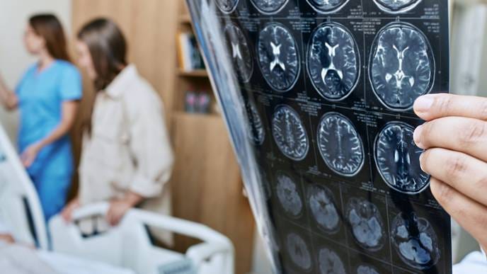 Alzheimer’s cases medical procedure Alzheimer’s cases medical procedure