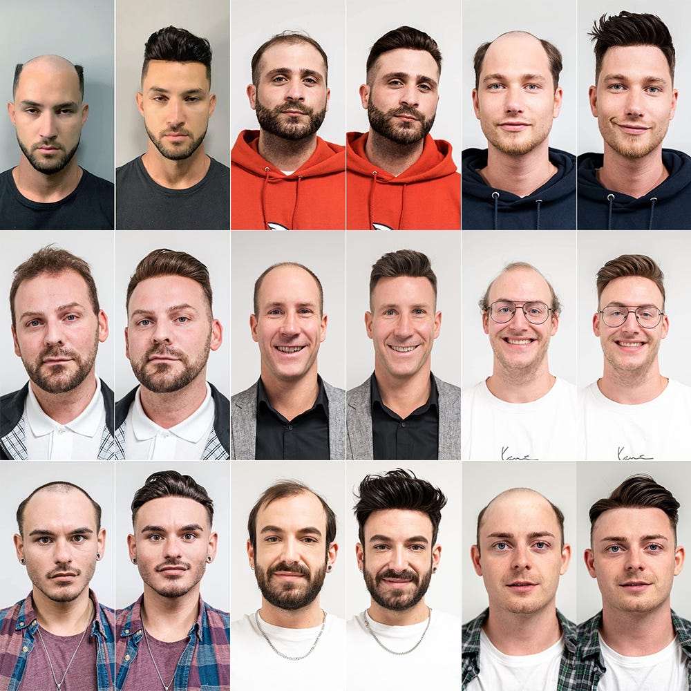 Factory Custom Silk Breathable Human Men Wigs Toupee Hair For Men - Buy  Human Hair Wigs For Men,Men Toupee Human Hair,Toupee Man Product on  Alibaba.com
