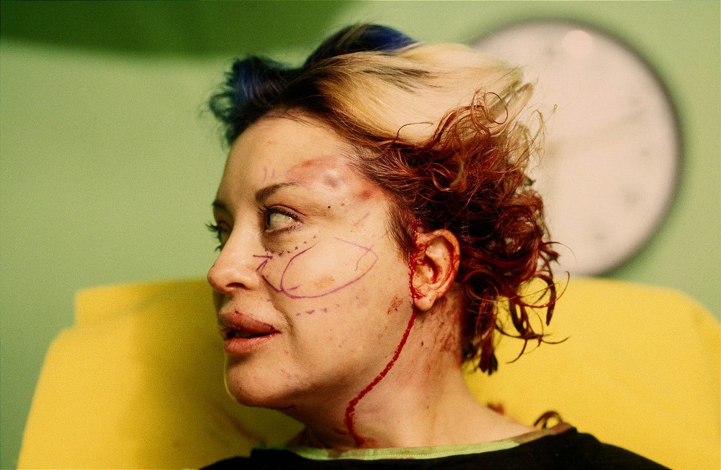 ORLAN