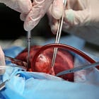 DISTURBING: Canada Is Turning Its Assisted Suicide Regime Into An Organ Donation Supply Chain