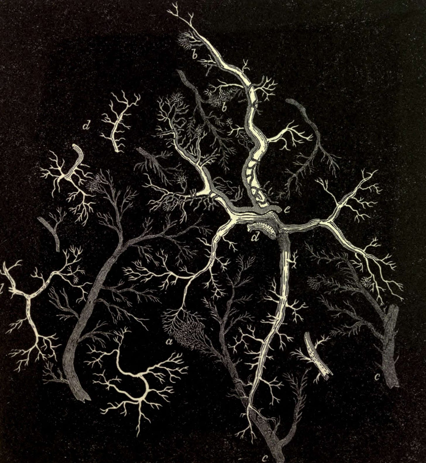 A cream on black engraving of the portal veins of the liver from an 1859 medical text. A cream on black engraving of the portal veins of the liver from an 1859 medical text.