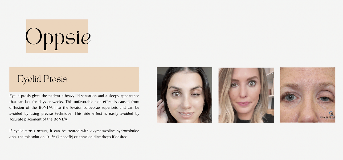 r/30PlusSkinCare - A Comprehensive Guide to Botox (including a very recent advancement the Navaclick Injection System) Edited to include images
