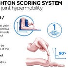 Your Pocket Guide to Understanding and Managing Hypermobility and Ehlers-Danlos Syndrome