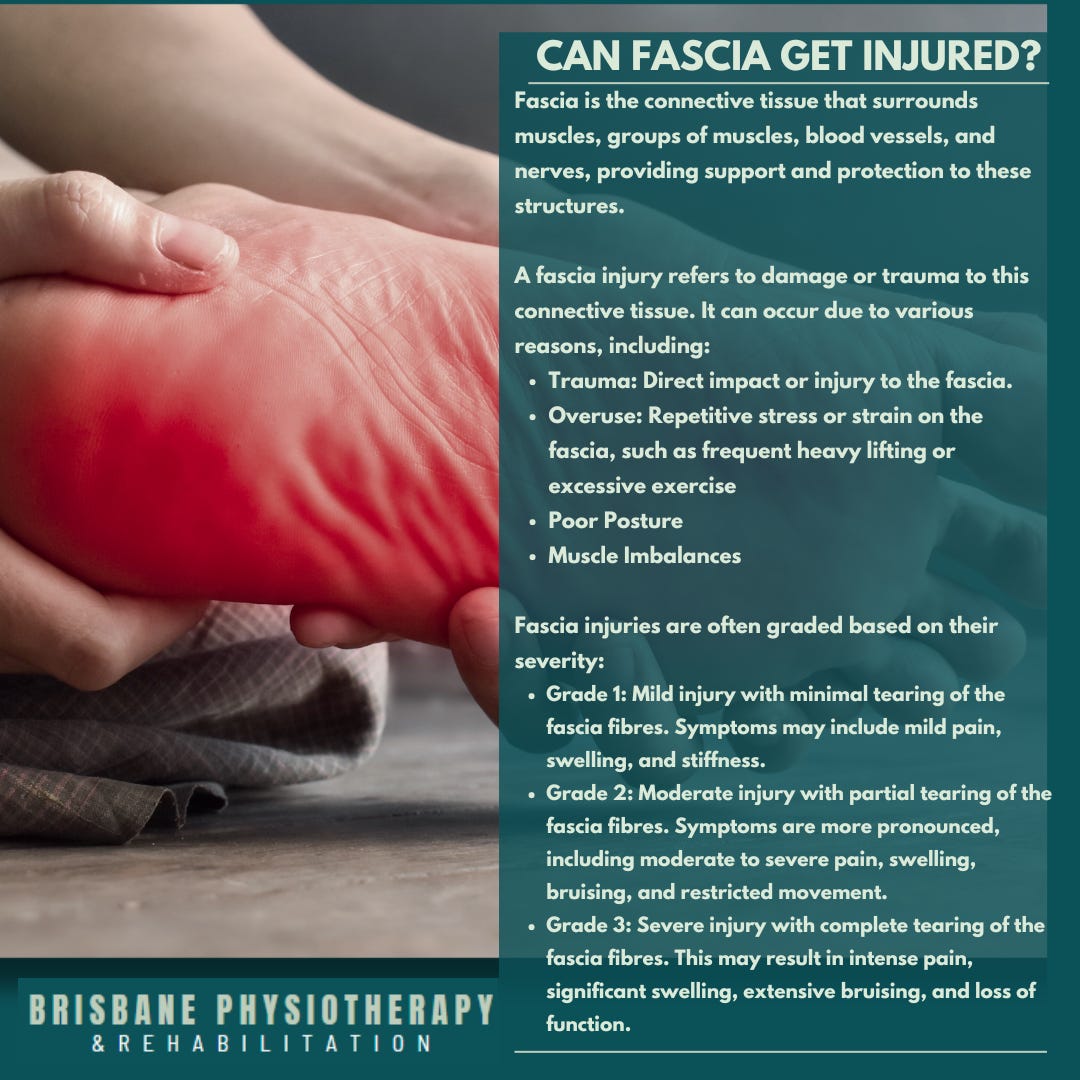 Can Fascia Get Injured? - Brisbane Physiotherapy & Podiatry