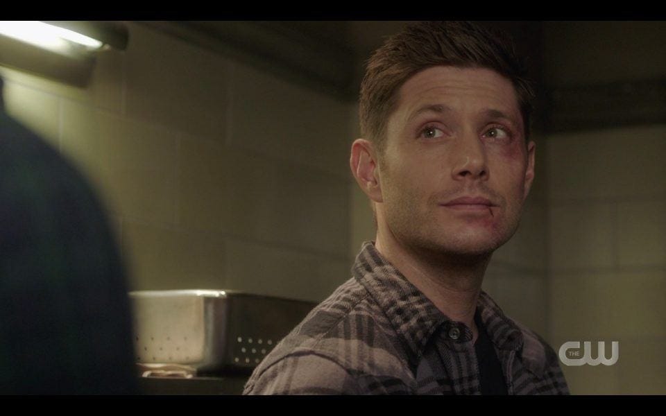 spn 1413 dean winchester beat up face would we be better off spn 1413 dean winchester beat up face would we be better off