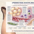 More Reactions, Fewer Antibodies: The IgG Mystery in Lipedema