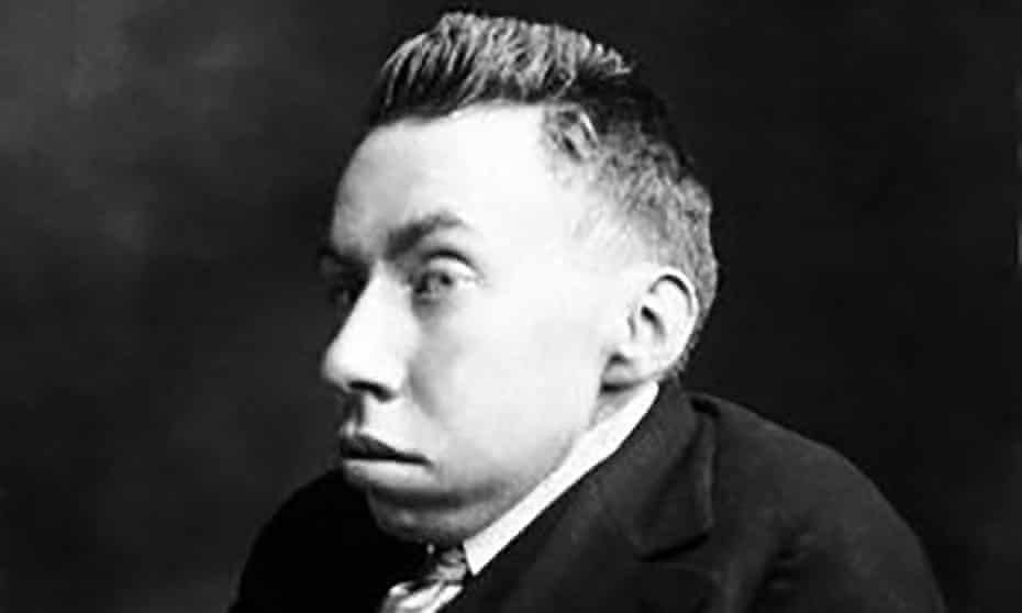 Impassioned pacifist Randolph Bourne was undaunted by years of discrimination