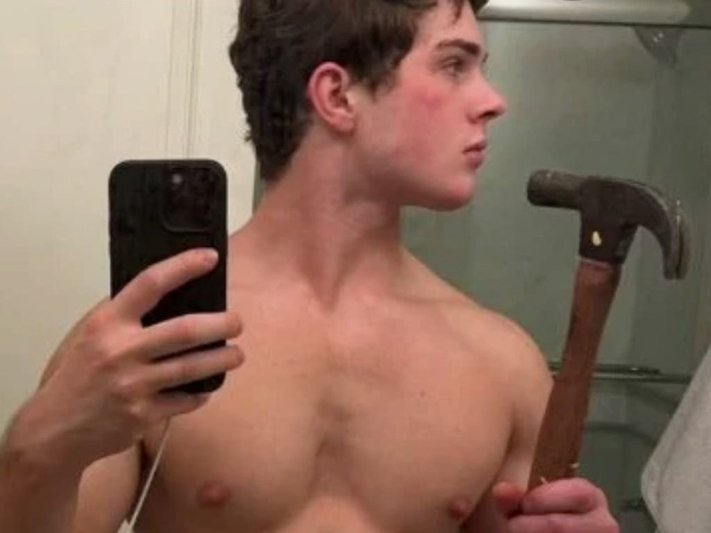 Looksmaxxing bonesmashing trend sees young men hammer jaws for better looks  | The Australian