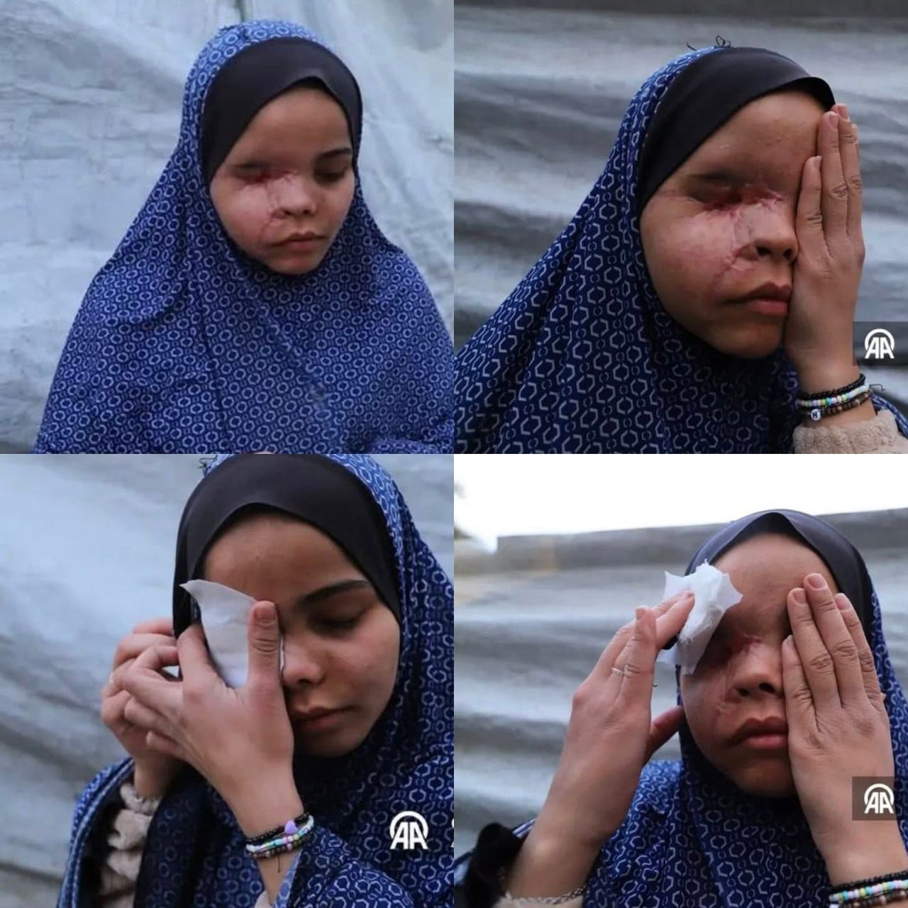 Migliaia di persone a Gaza sull'orlo della cecità mentre Israele distrugge strutture di assistenza oculistica - Palestine Will Be Free