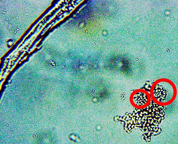 Replication of Electrical Transformation of C19 Unvaccinated Blood - Filament Growth Documented - CDB Extraction and Isolation -Ana Mihalcea, MD, PhD in Conjunction with Clifford Carnicom