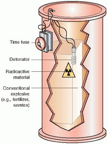 Radiologic Terrorism | Radiology Key