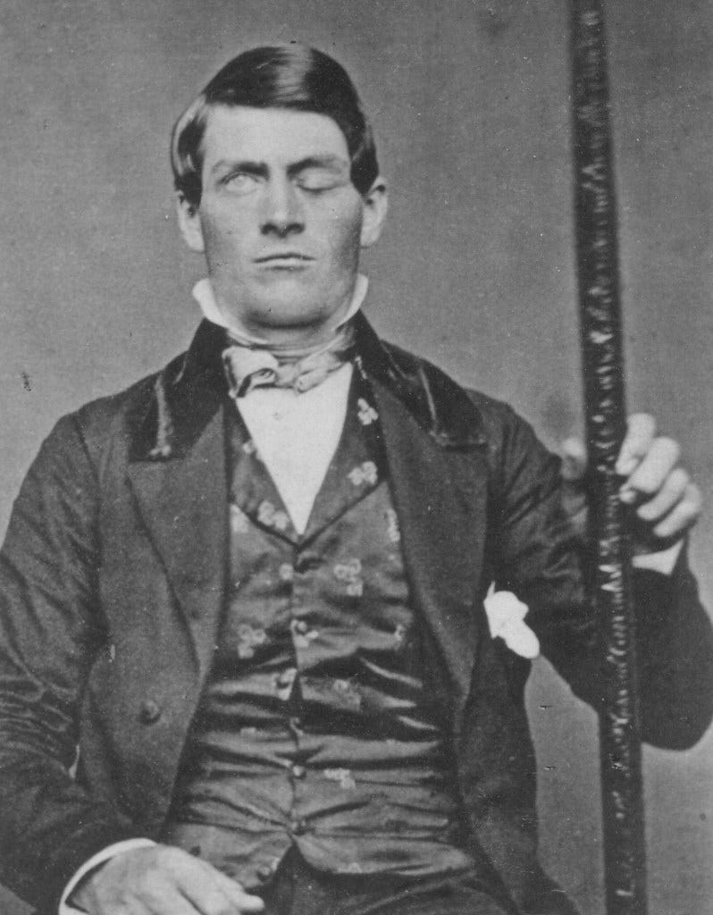 Phineas Gage