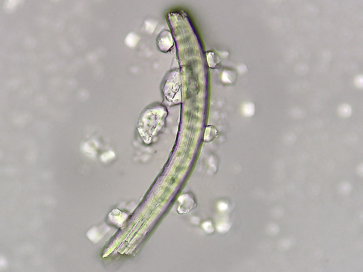 More 'Things' in urine samples