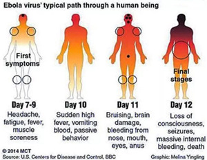 Ebola4 Ebola4