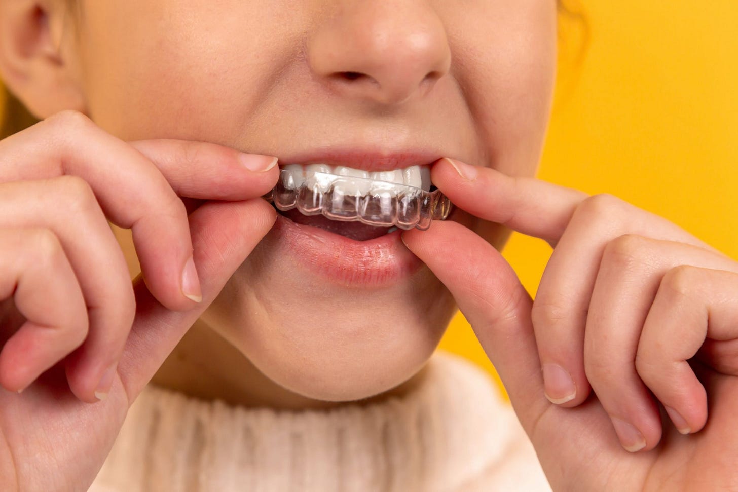 Retainer Types: Bonded, Hawley and Clear Retainers