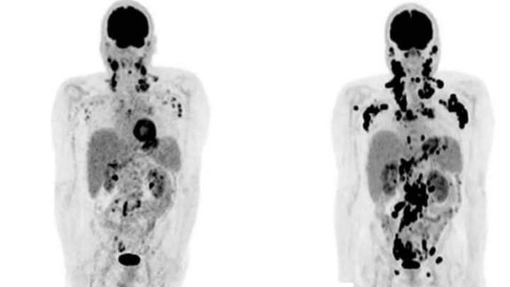 Veja os danos devastadores que a proteína spike da vacina covid causa e como você pode neutralizá-la Veja os danos devastadores que a proteína spike da vacina covid causa e como você pode neutralizá-la