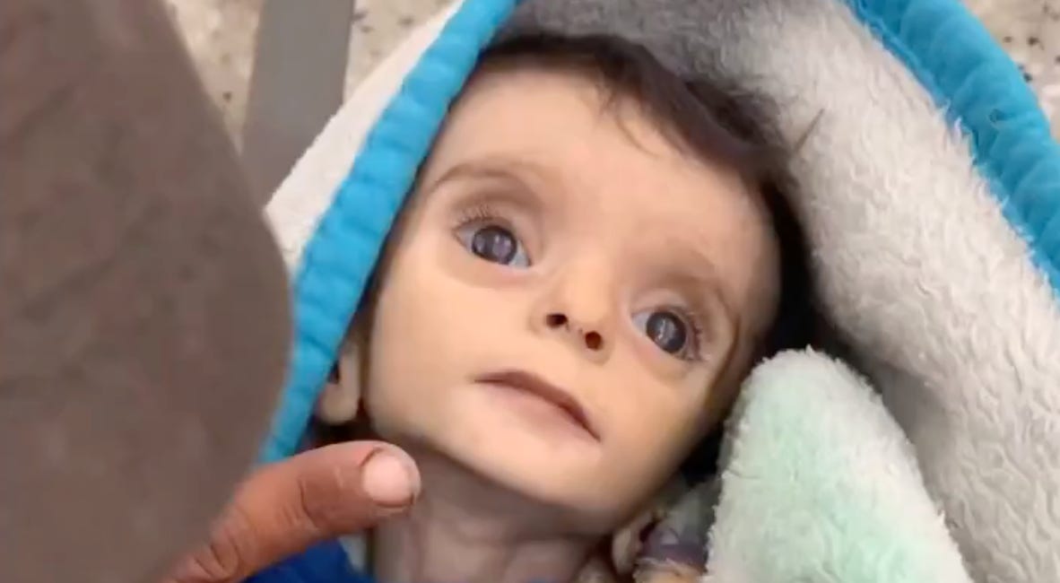 🕯️ This Little Baby Boy Was Starved to Death Today in Gaza