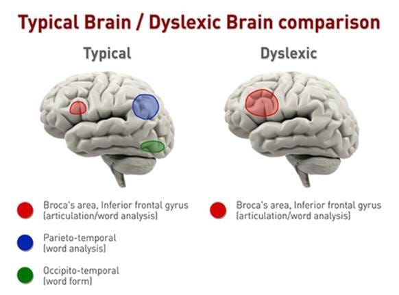 dyslexie2.png