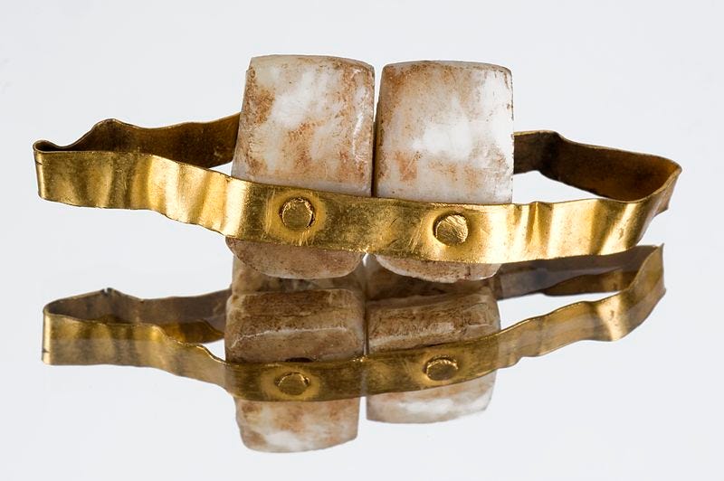 File:Copy of an Etruscan denture, Europe, 1901-1930 Wellcome L0058137.jpg File:Copy of an Etruscan denture, Europe, 1901-1930 Wellcome L0058137.jpg