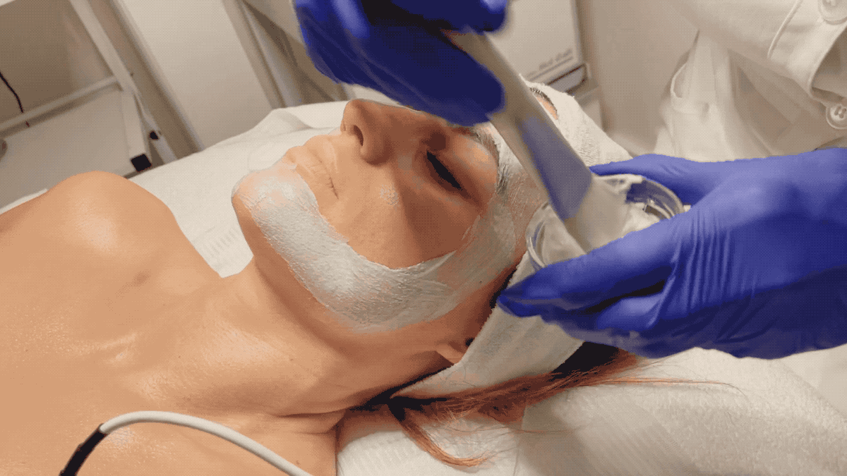 All About Chemical Peels – La Suite Skincare All About Chemical Peels – La Suite Skincare