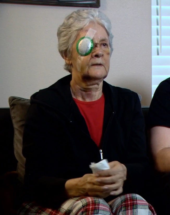 Assault victim Jeanette Marken with an eye patch, bandages, and bruising on her face.