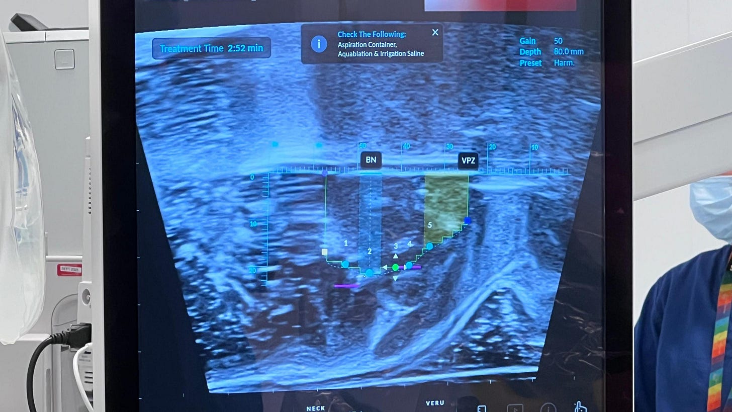 Close-up of a medical imaging monitor displaying a scan and measurement markers during a procedure, with clinical equipment visible around the screen. Close-up of a medical imaging monitor displaying a scan and measurement markers during a procedure, with clinical equipment visible around the screen.