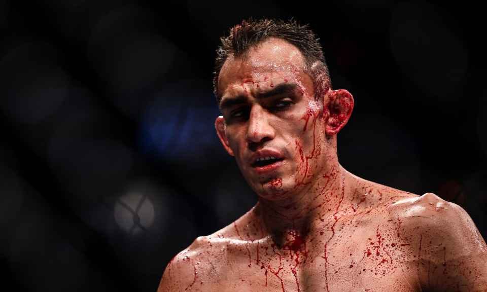Tony Ferguson is the elbow-sharpening, blood-splattering UFC maverick who  busts faces up and is itching to hurt Conor McGregor | talkSPORT