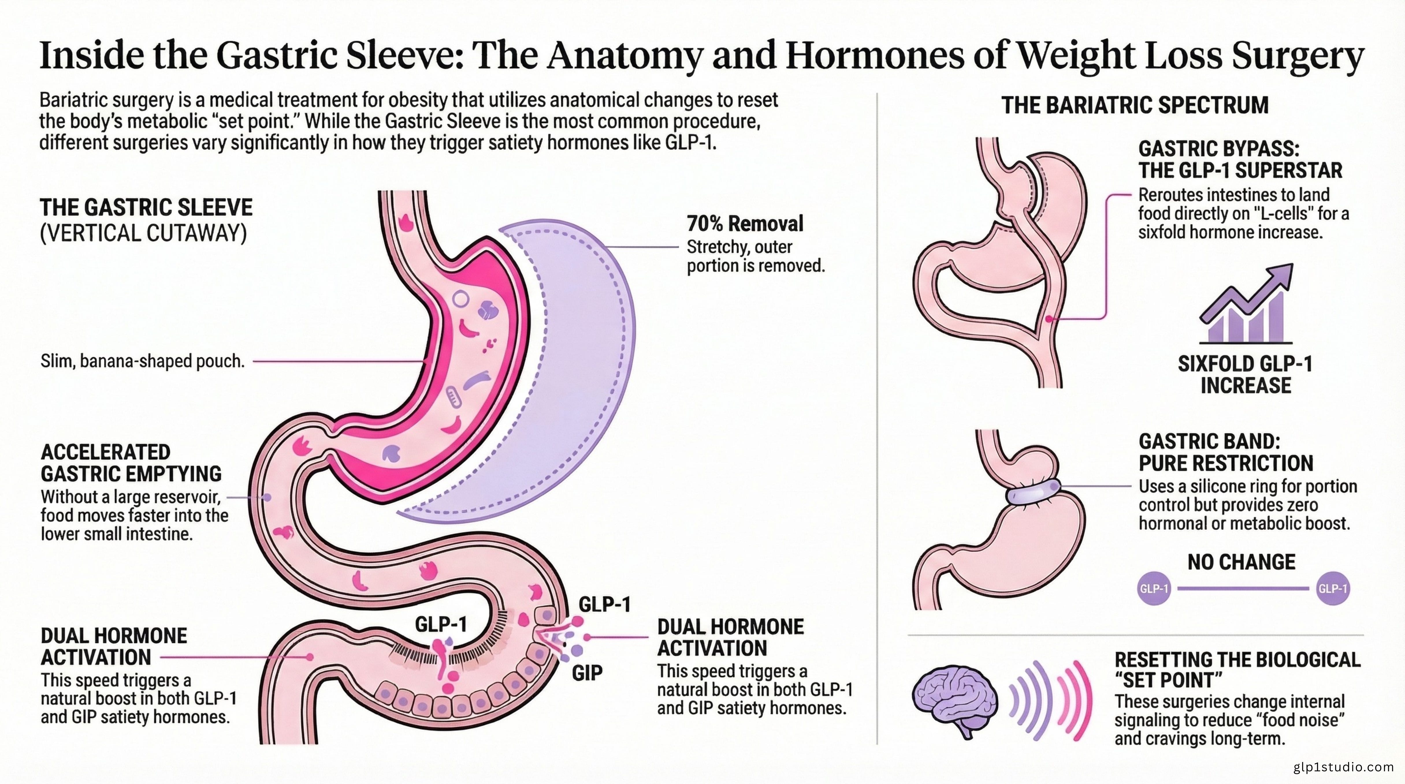 Bariatric Surgery vs GLP-1 Medication: Treating Obesity as a Disease