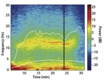 EEG to guide the depth of anesthesia in infants