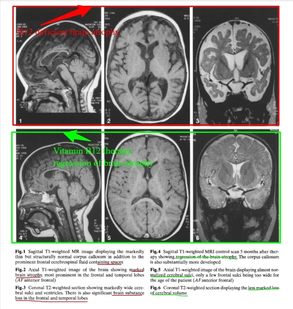 https%3A%2F%2Fsubstack post media.s3.amazonaws.com%2Fpublic%2Fimages%2F8ab60908 1268 4979 9c18