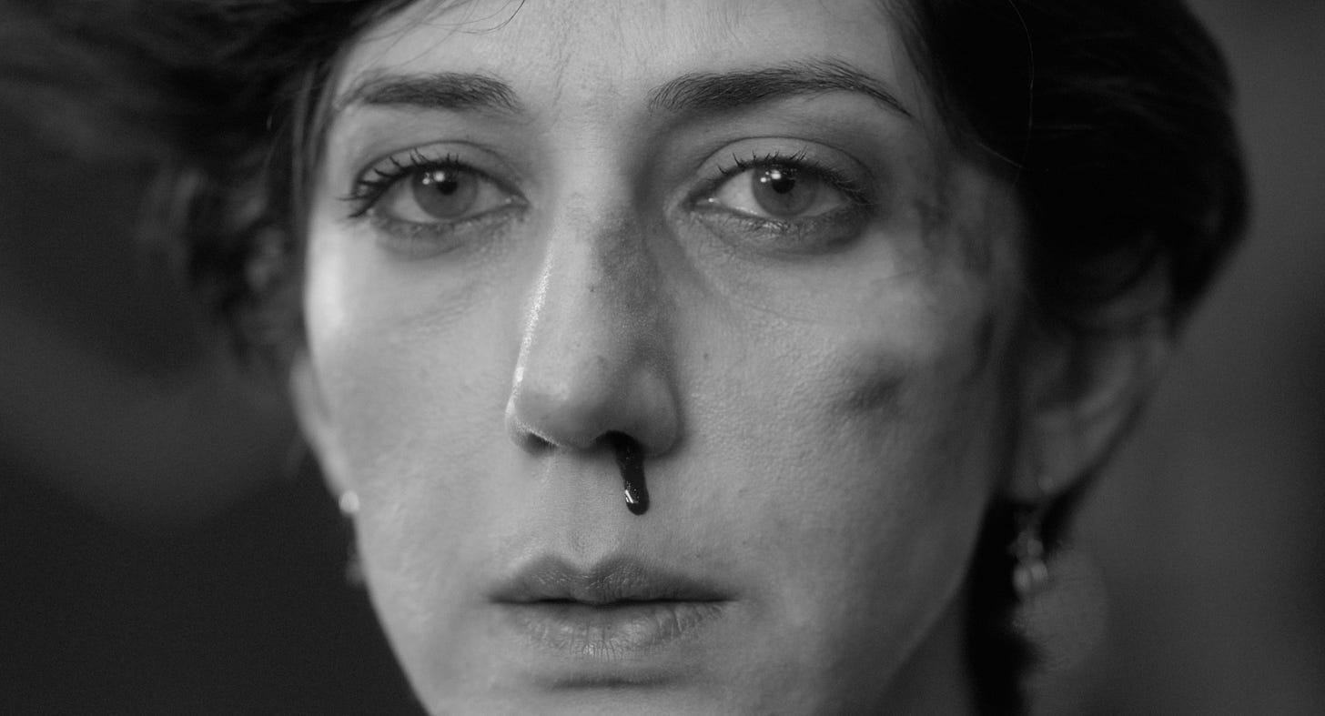 A black and white photo of a woman with a bloody nose and a bruised face.