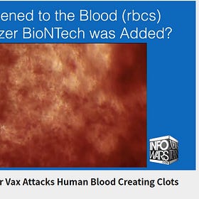 Dr. Richard Fleming tests Pfizer Vaccine on Blood