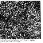 The Big tau: A new hope for Alzheimer's?