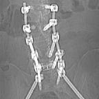 Carlos Sánchez Almeida