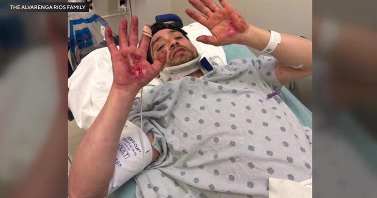 ICE agent allegedly rams immigrant's vehicle, leaving him injured | National and World News | channel3000.com ICE agent allegedly rams immigrant's vehicle, leaving him injured | National and World News | channel3000.com