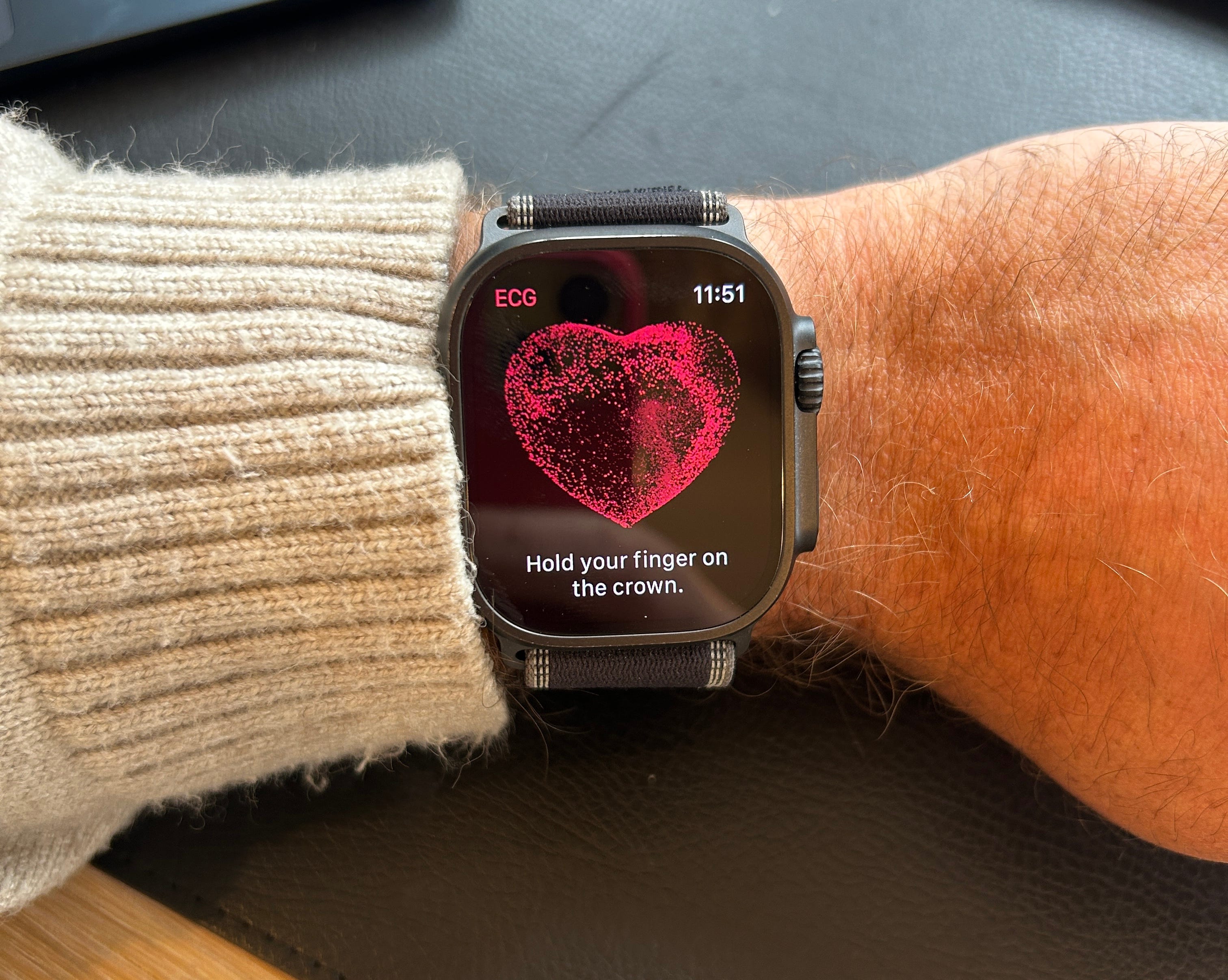 What 80 Young People with AFib Told Us (That No Clinical Study Would)