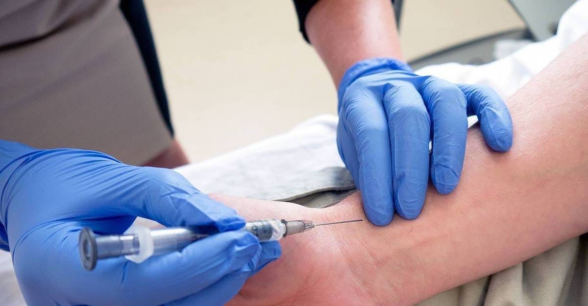 Arterial Blood Gas (ABG) Analysis | Values & Interpretation