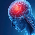 2026 Guideline Update: Early Management of Ischemic Stroke