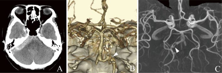 An external file that holds a picture, illustration, etc.
Object name is 2188-4226-9-0095-g003.jpg