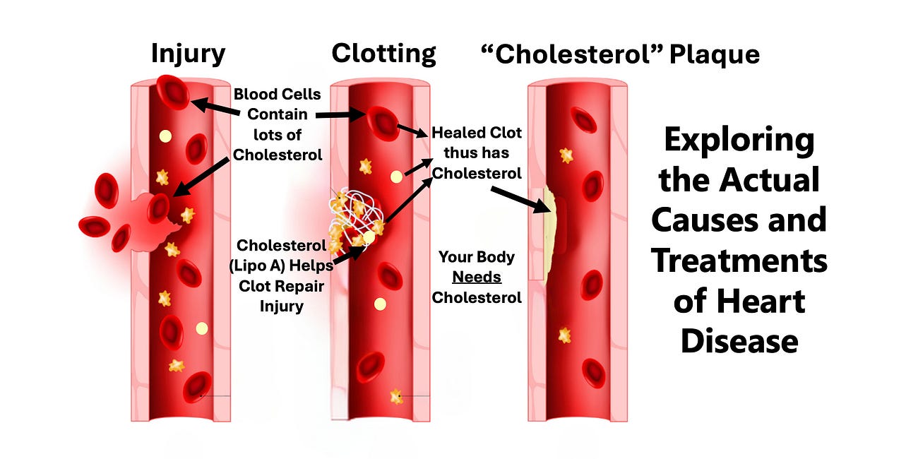 The Great Cholesterol Scam and The Dangers of Statins