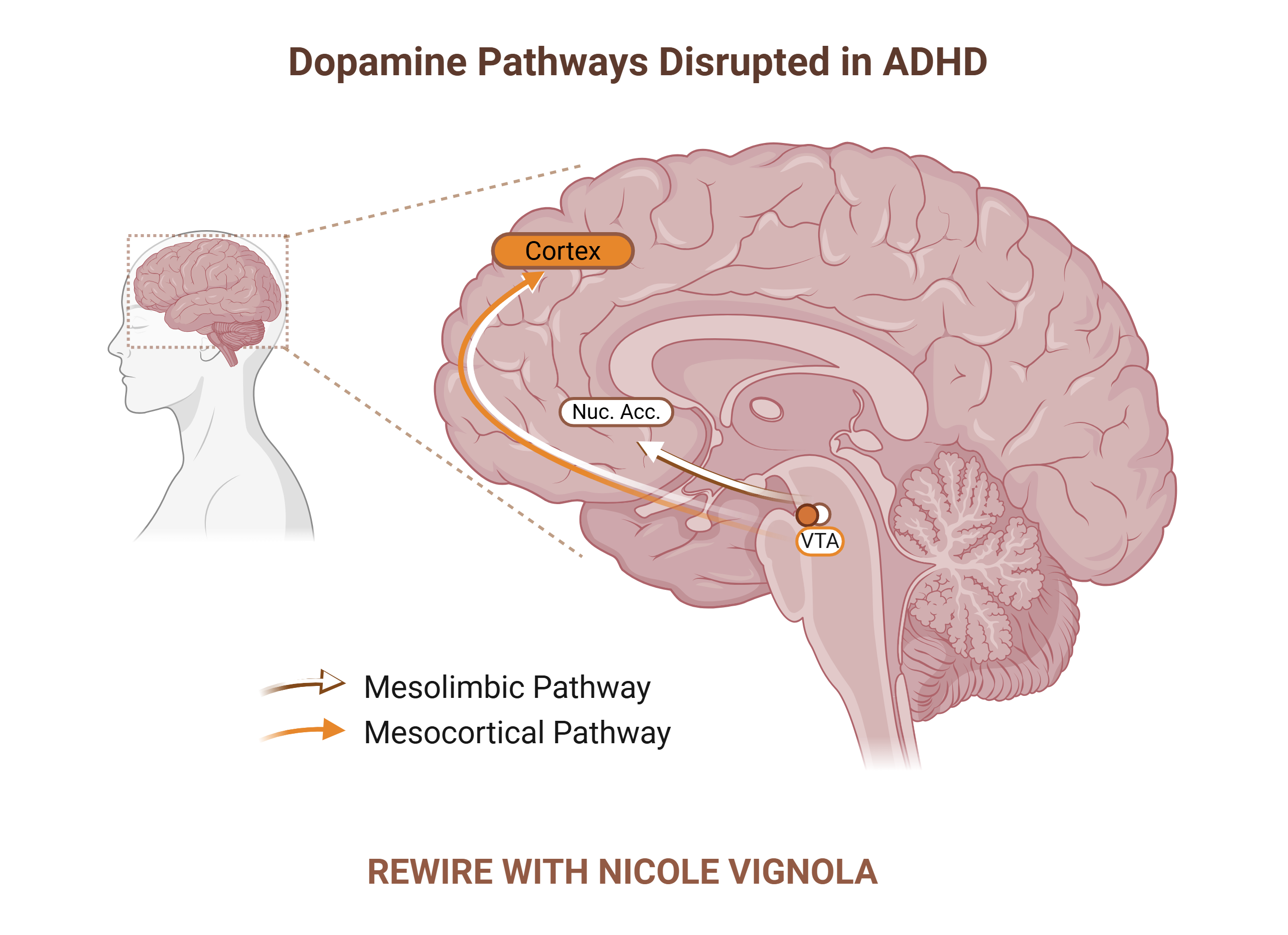 how-adhd-shapes-motivation-and-what-to-do-about-it