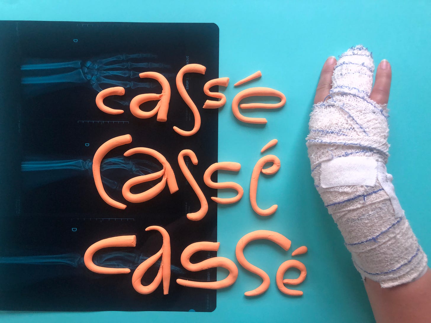 Clay letters that read "Cassé cassé cassé" or "broken broken broken" on a paper and xray background. On the right is a broken hand wrapped in bandages.