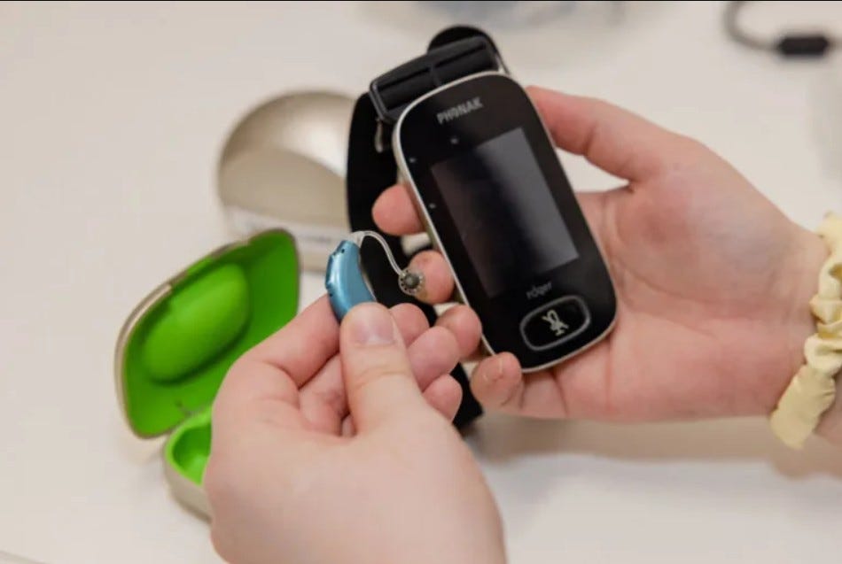 Modern hearing aids displayed on a table showing different hearing aid styles and designs for everyday comfort and clarity. Modern hearing aids displayed on a table showing different hearing aid styles and designs for everyday comfort and clarity.