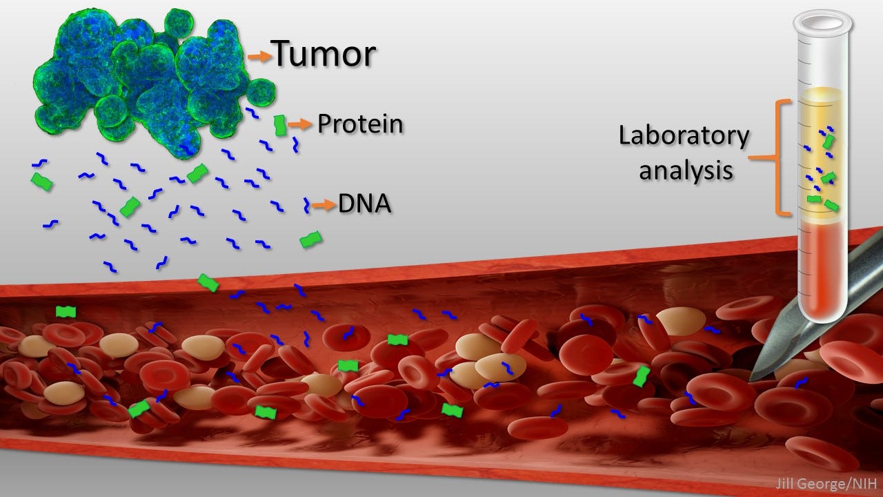 New 'Liquid Biopsy' Shows Early Promise in Detecting Cancer – NIH  Director's Blog