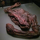 The Mysterious Bog Bodies of Northern Europe