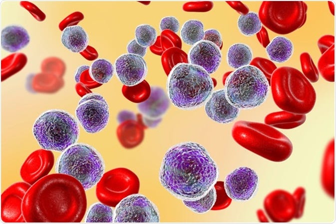 Leukemia and Childhood Infection Hypothesis
